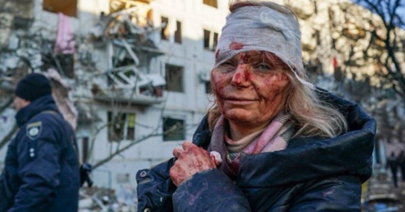 Το πρόσωπο του πολέμου: Το πικρό χαμόγελο της γυναίκας που συγκλόνισε όλο τον πλανήτη