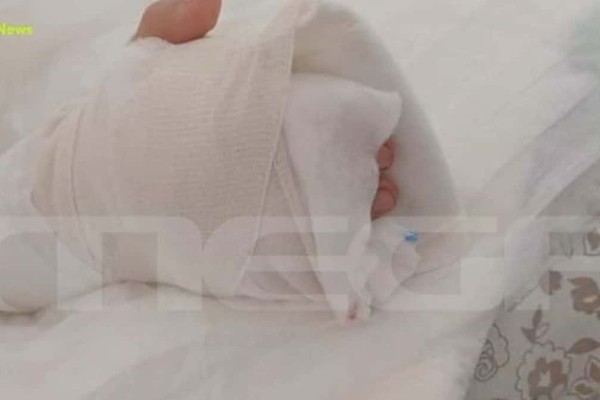 Εφιάλτης σε παιδική χαρά στη Θεσσαλονίκη: Αποκολλήθηκε το δάχτυλό 8χρονης – Συγκλονίζει η μητέρα