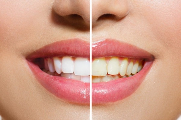 Το απίστευτο τρικ για να κάνεις τα δόντια σου λευκά χωρίς οδοντόκρεμα – Ομορφιά & Υγεία